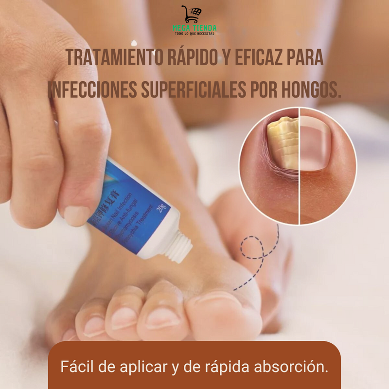 Crema Antifúngica™- Solución Rápida y Eficaz